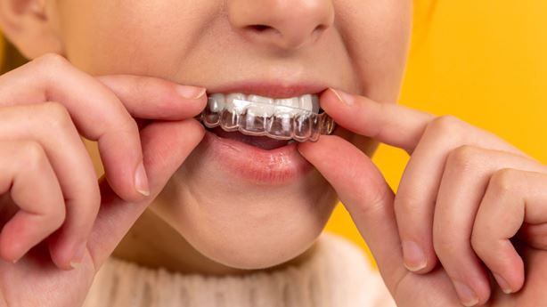 Teeth Whitening After Braces Nedlands Dental