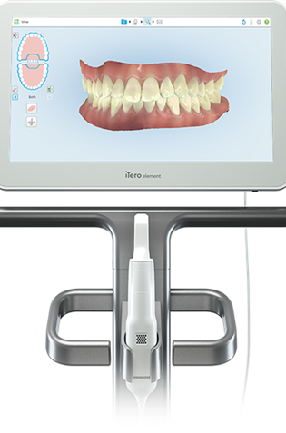 Invisalign Treatment Is Effective At Correcting Overbite Issues