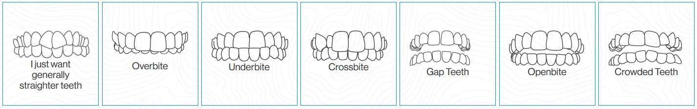 Types of dental issues that Invisalign can fix including overbites and underbites